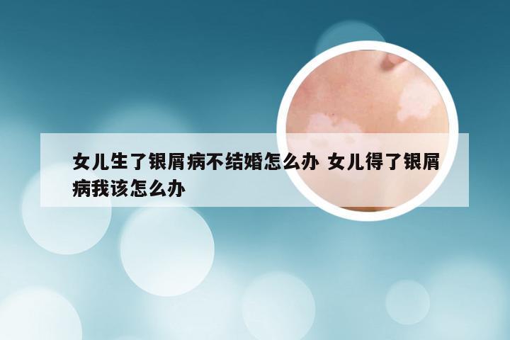 女儿生了银屑病不结婚怎么办 女儿得了银屑病我该怎么办