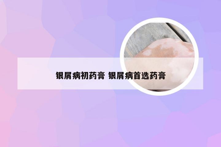 银屑病初药膏 银屑病首选药膏