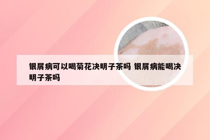 银屑病可以喝菊花决明子茶吗 银屑病能喝决明子茶吗
