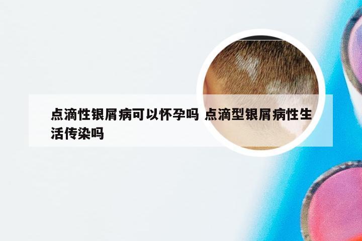 点滴性银屑病可以怀孕吗 点滴型银屑病性生活传染吗