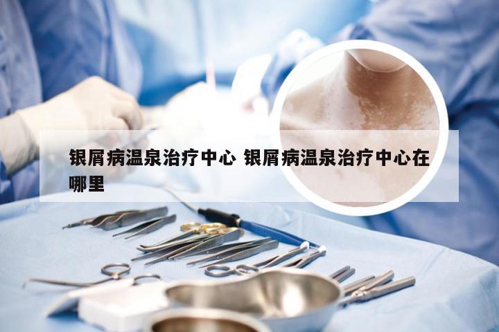 银屑病温泉治疗中心 银屑病温泉治疗中心在哪里