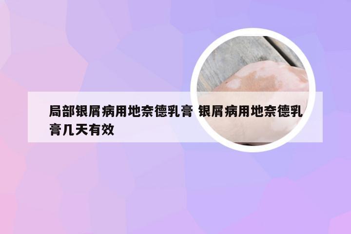 局部银屑病用地奈德乳膏 银屑病用地奈德乳膏几天有效