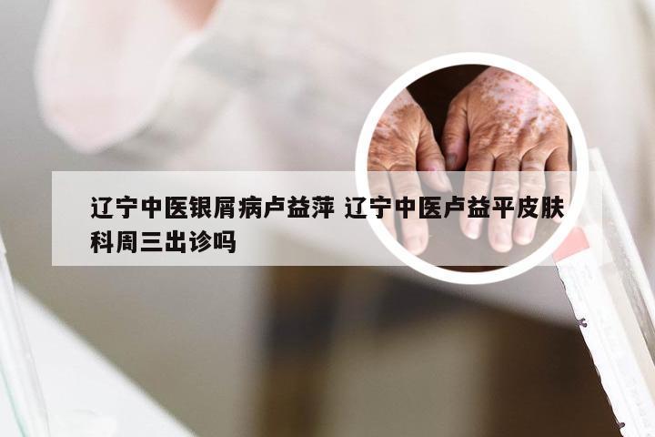 辽宁中医银屑病卢益萍 辽宁中医卢益平皮肤科周三出诊吗