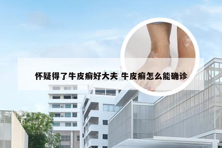 怀疑得了牛皮癣好大夫 牛皮癣怎么能确诊