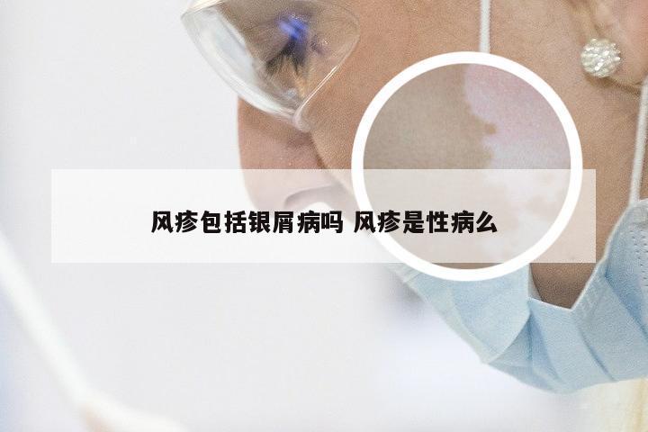 风疹包括银屑病吗 风疹是性病么
