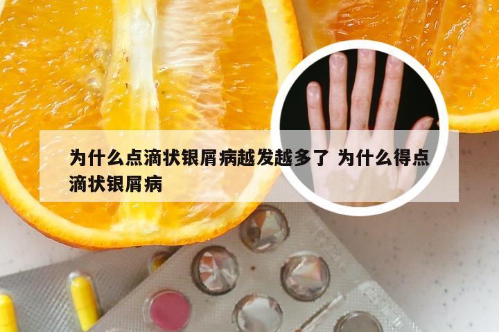 为什么点滴状银屑病越发越多了 为什么得点滴状银屑病