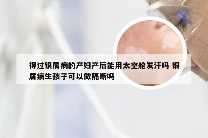 得过银屑病的产妇产后能用太空舱发汗吗 银屑病生孩子可以做隔断吗