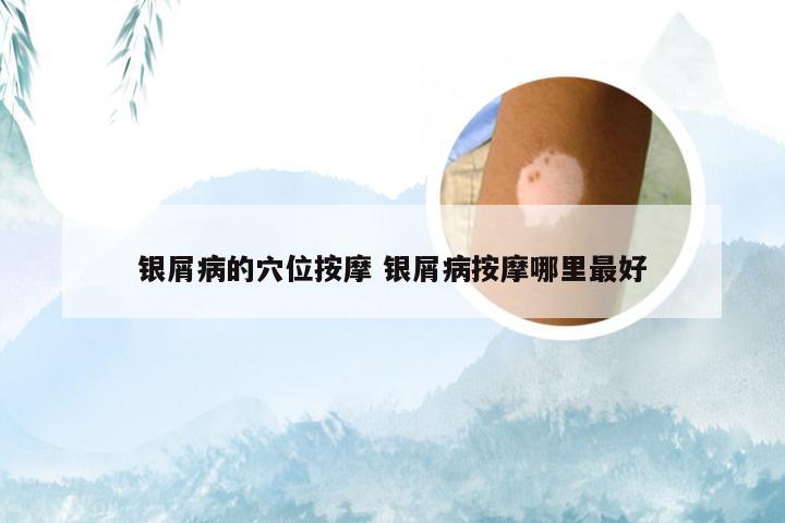 银屑病的穴位按摩 银屑病按摩哪里最好