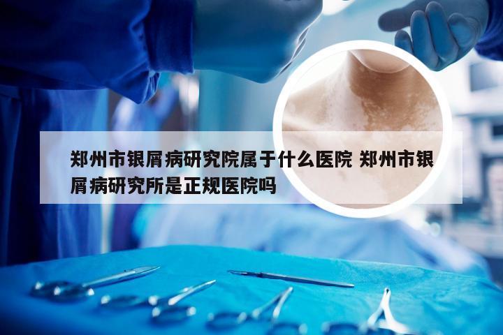 郑州市银屑病研究院属于什么医院 郑州市银屑病研究所是正规医院吗