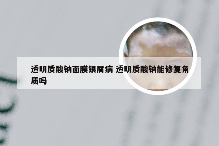 透明质酸钠面膜银屑病 透明质酸钠能修复角质吗