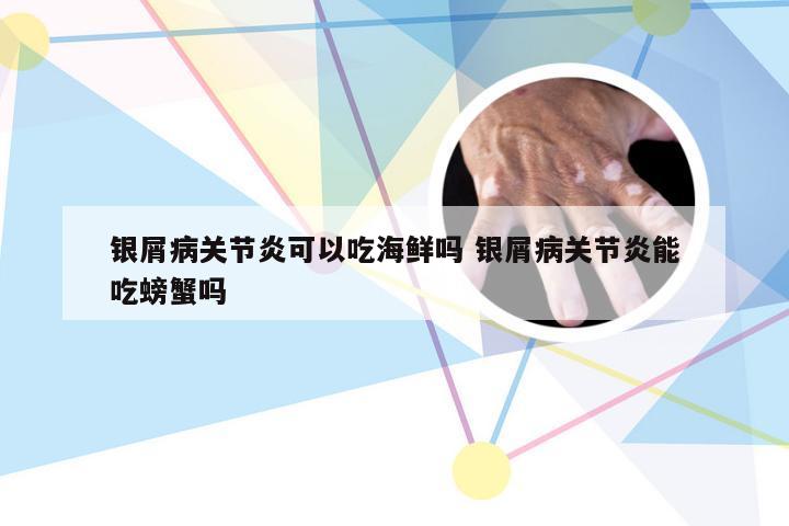 银屑病关节炎可以吃海鲜吗 银屑病关节炎能吃螃蟹吗