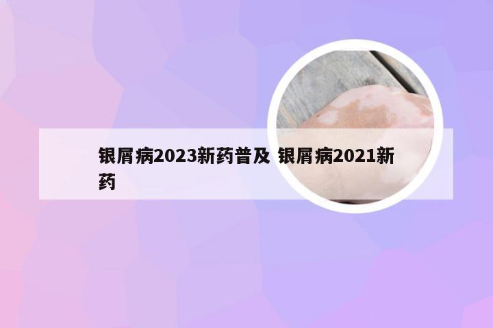 银屑病2023新药普及 银屑病2021新药