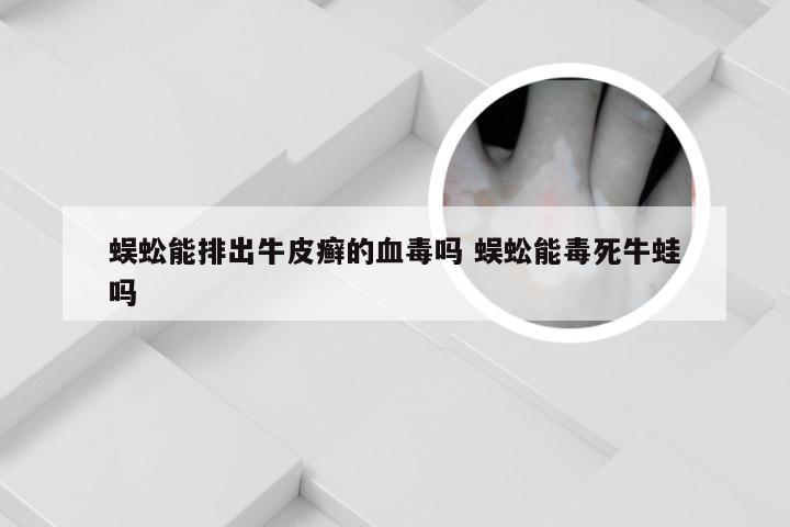 蜈蚣能排出牛皮癣的血毒吗 蜈蚣能毒死牛蛙吗