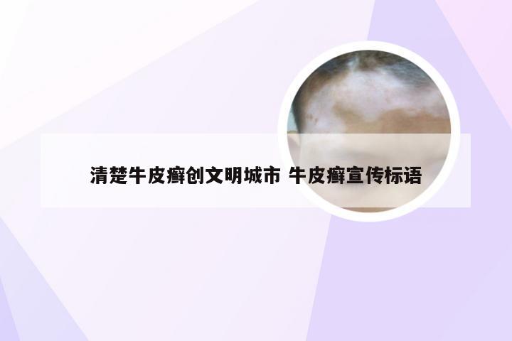 清楚牛皮癣创文明城市 牛皮癣宣传标语