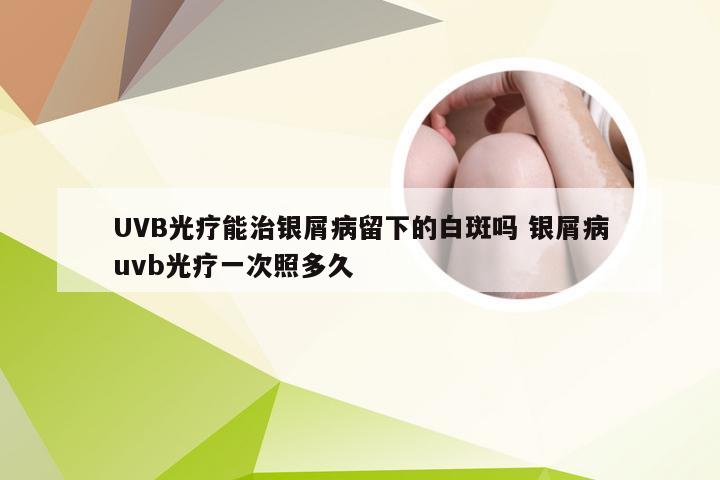 UVB光疗能治银屑病留下的白斑吗 银屑病uvb光疗一次照多久