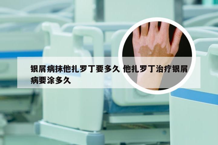 银屑病抹他扎罗丁要多久 他扎罗丁治疗银屑病要涂多久