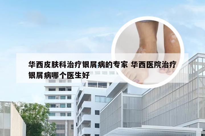 华西皮肤科治疗银屑病的专家 华西医院治疗银屑病哪个医生好
