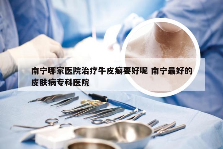 南宁哪家医院治疗牛皮癣要好呢 南宁最好的皮肤病专科医院