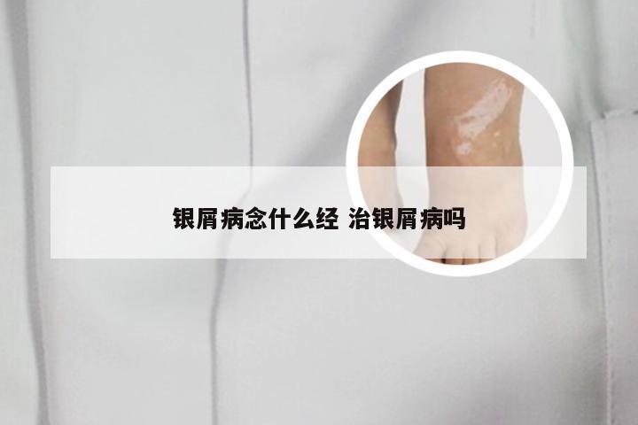 银屑病念什么经 治银屑病吗
