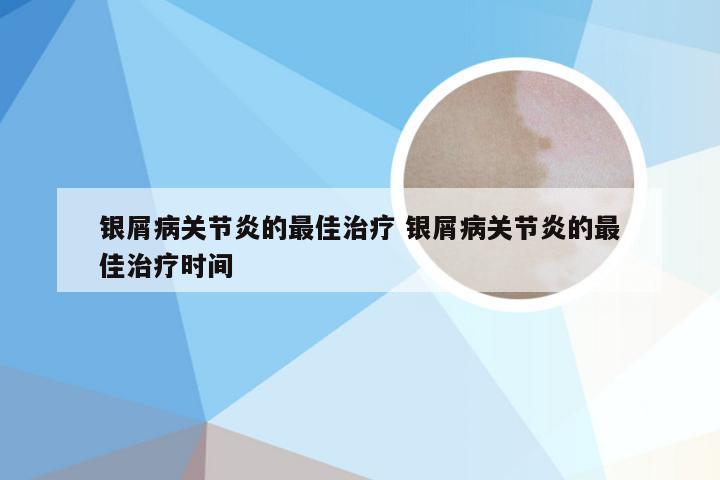 银屑病关节炎的最佳治疗 银屑病关节炎的最佳治疗时间