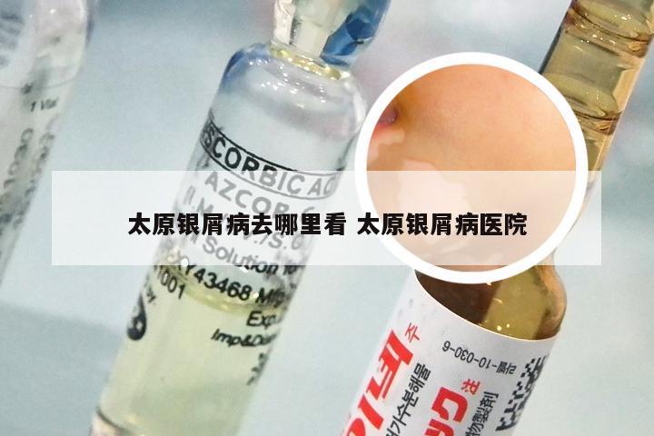太原银屑病去哪里看 太原银屑病医院