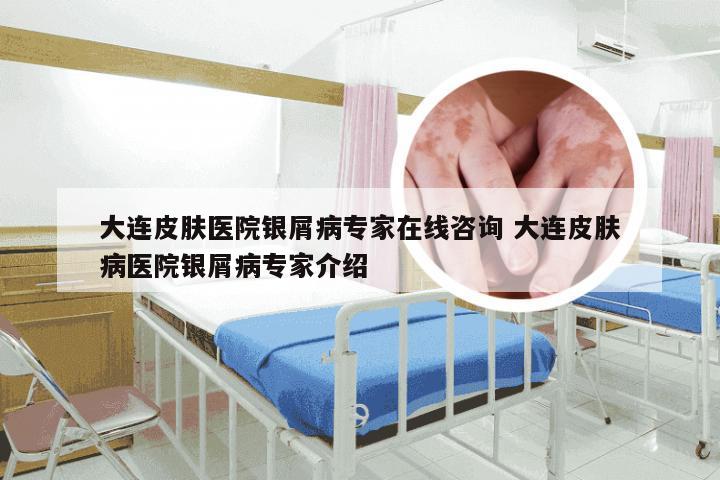 大连皮肤医院银屑病专家在线咨询 大连皮肤病医院银屑病专家介绍