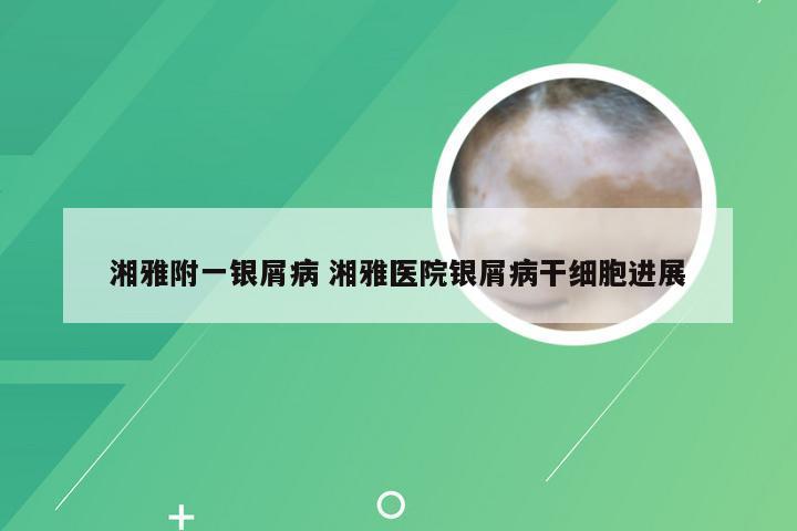 湘雅附一银屑病 湘雅医院银屑病干细胞进展