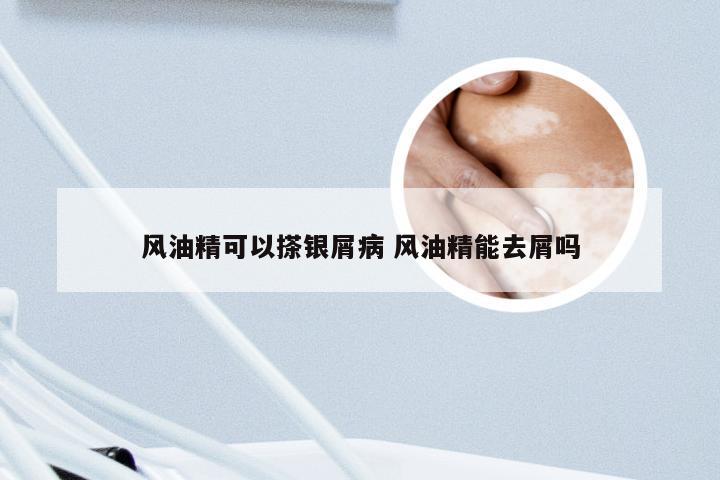 风油精可以搽银屑病 风油精能去屑吗