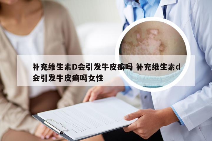 补充维生素D会引发牛皮癣吗 补充维生素d会引发牛皮癣吗女性