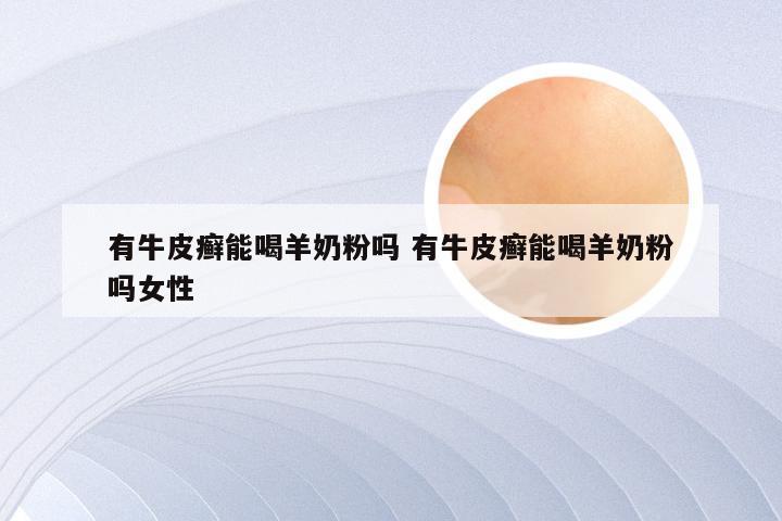 有牛皮癣能喝羊奶粉吗 有牛皮癣能喝羊奶粉吗女性