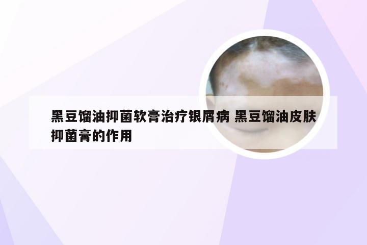 黑豆馏油抑菌软膏治疗银屑病 黑豆馏油皮肤抑菌膏的作用