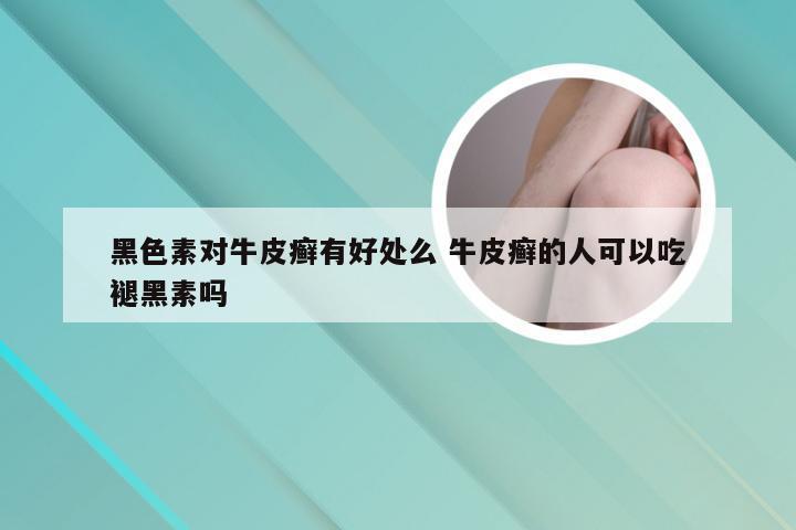 黑色素对牛皮癣有好处么 牛皮癣的人可以吃褪黑素吗