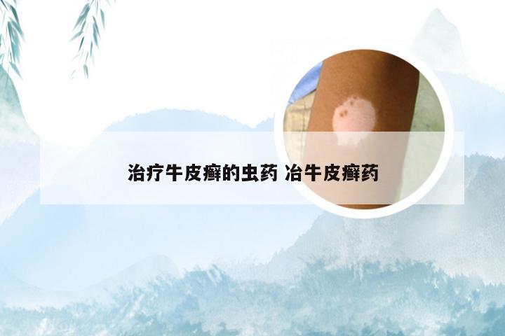 治疗牛皮癣的虫药 冶牛皮癣药