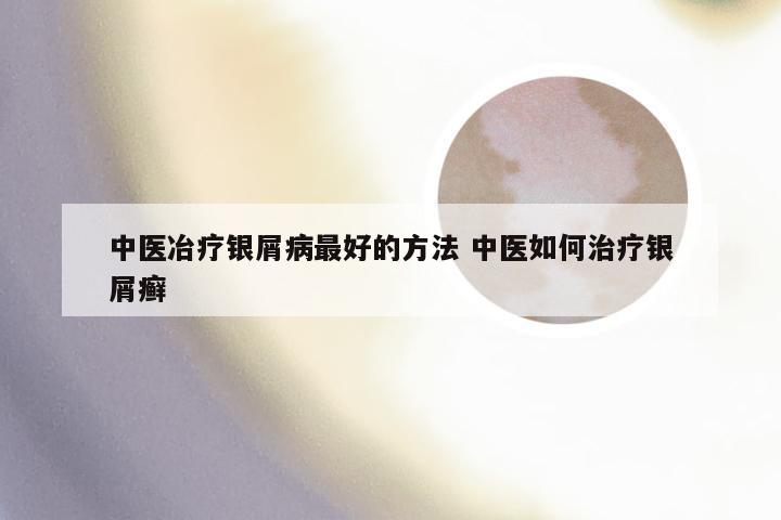 中医冶疗银屑病最好的方法 中医如何治疗银屑癣