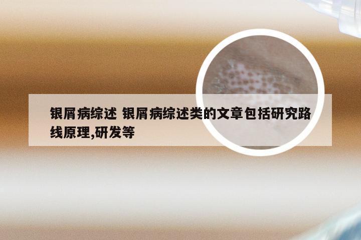 银屑病综述 银屑病综述类的文章包括研究路线原理,研发等