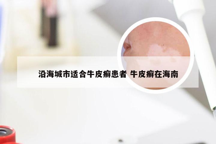 沿海城市适合牛皮癣患者 牛皮癣在海南
