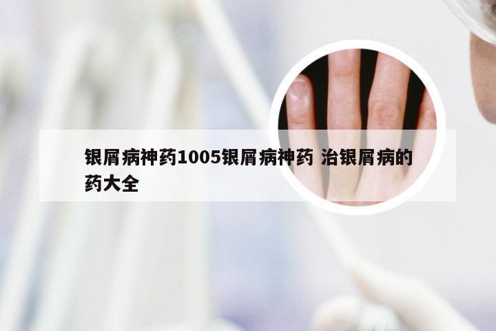 银屑病神药1005银屑病神药 治银屑病的药大全