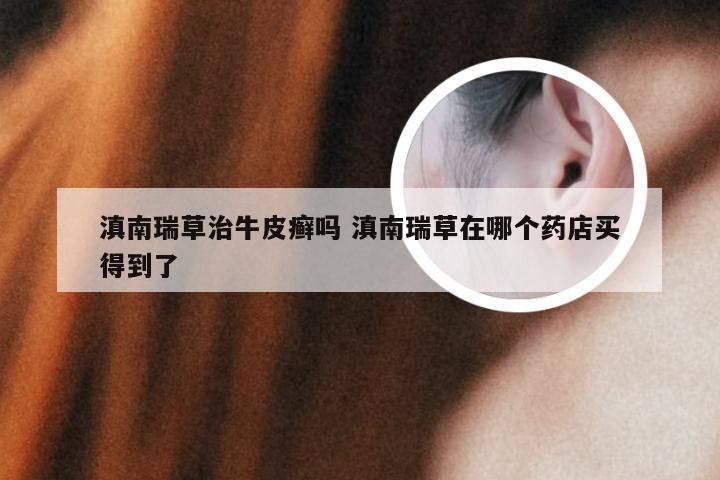 滇南瑞草治牛皮癣吗 滇南瑞草在哪个药店买得到了
