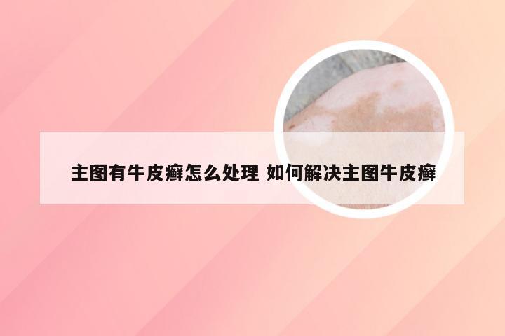 主图有牛皮癣怎么处理 如何解决主图牛皮癣