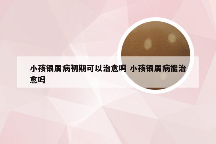 小孩银屑病初期可以治愈吗 小孩银屑病能治愈吗