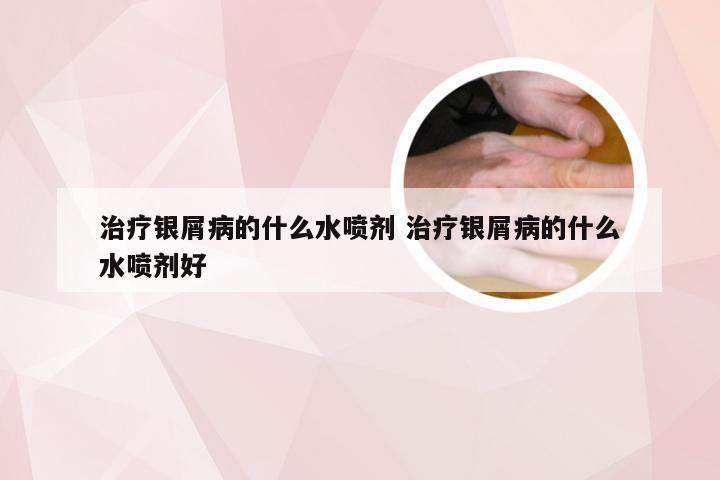 治疗银屑病的什么水喷剂 治疗银屑病的什么水喷剂好