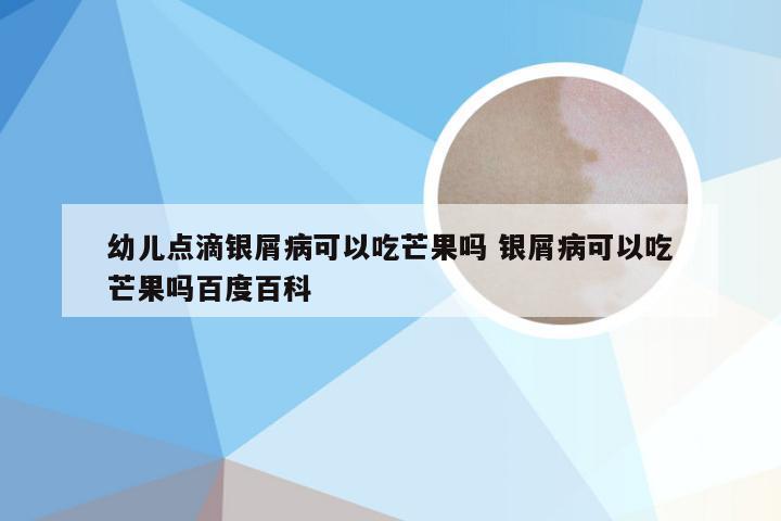 幼儿点滴银屑病可以吃芒果吗 银屑病可以吃芒果吗百度百科