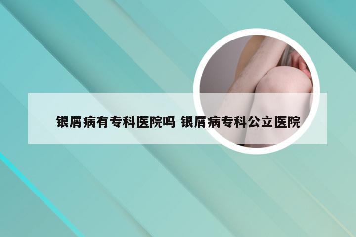 银屑病有专科医院吗 银屑病专科公立医院