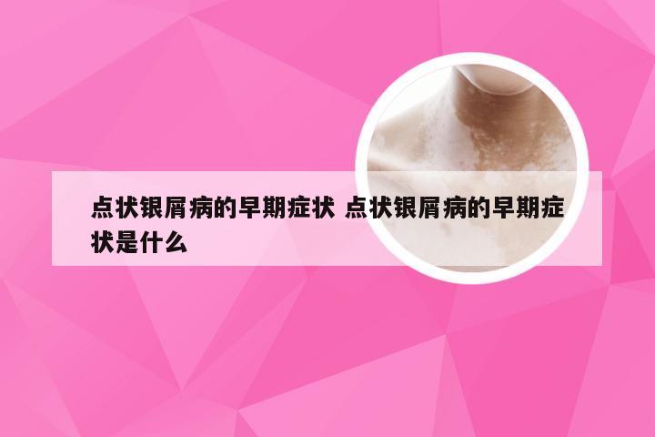 点状银屑病的早期症状 点状银屑病的早期症状是什么