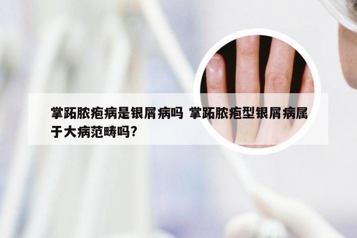 掌跖脓疱病是银屑病吗 掌跖脓疱型银屑病属于大病范畴吗?