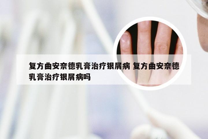 复方曲安奈德乳膏治疗银屑病 复方曲安奈德乳膏治疗银屑病吗