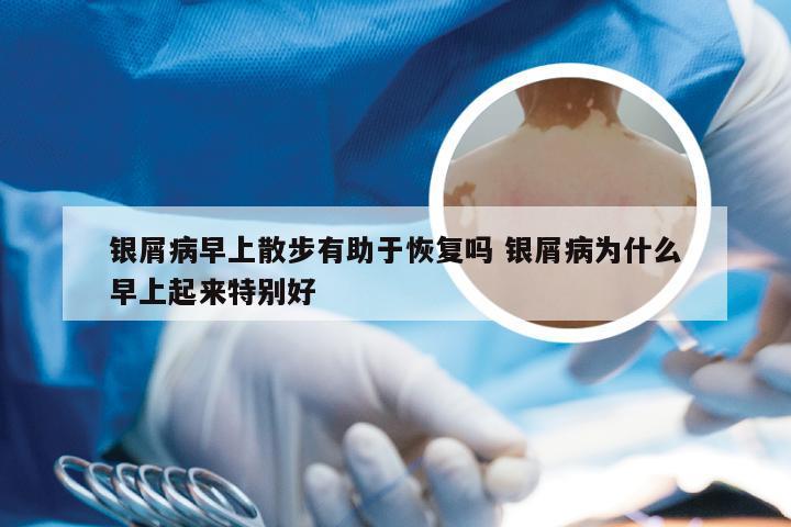 银屑病早上散步有助于恢复吗 银屑病为什么早上起来特别好