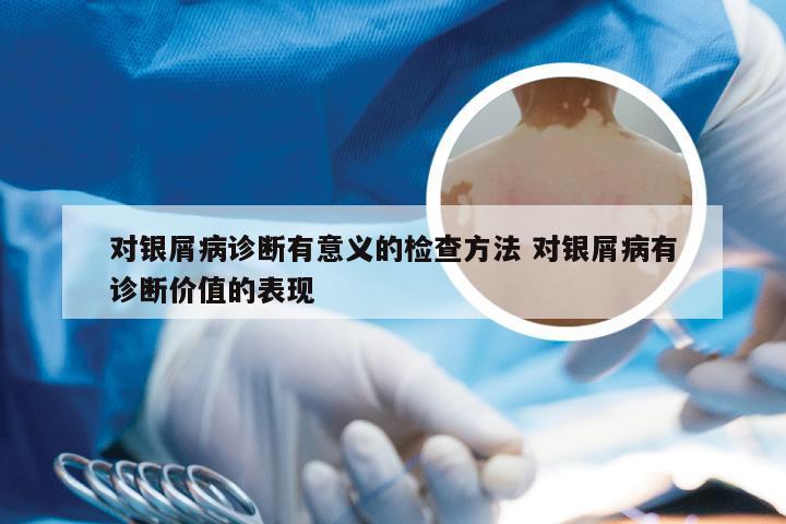 对银屑病诊断有意义的检查方法 对银屑病有诊断价值的表现