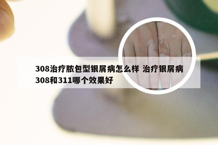 308治疗脓包型银屑病怎么样 治疗银屑病308和311哪个效果好