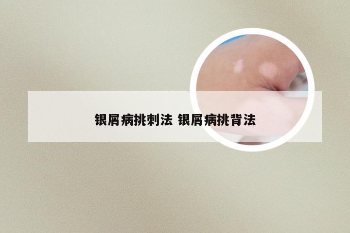 银屑病挑刺法 银屑病挑背法